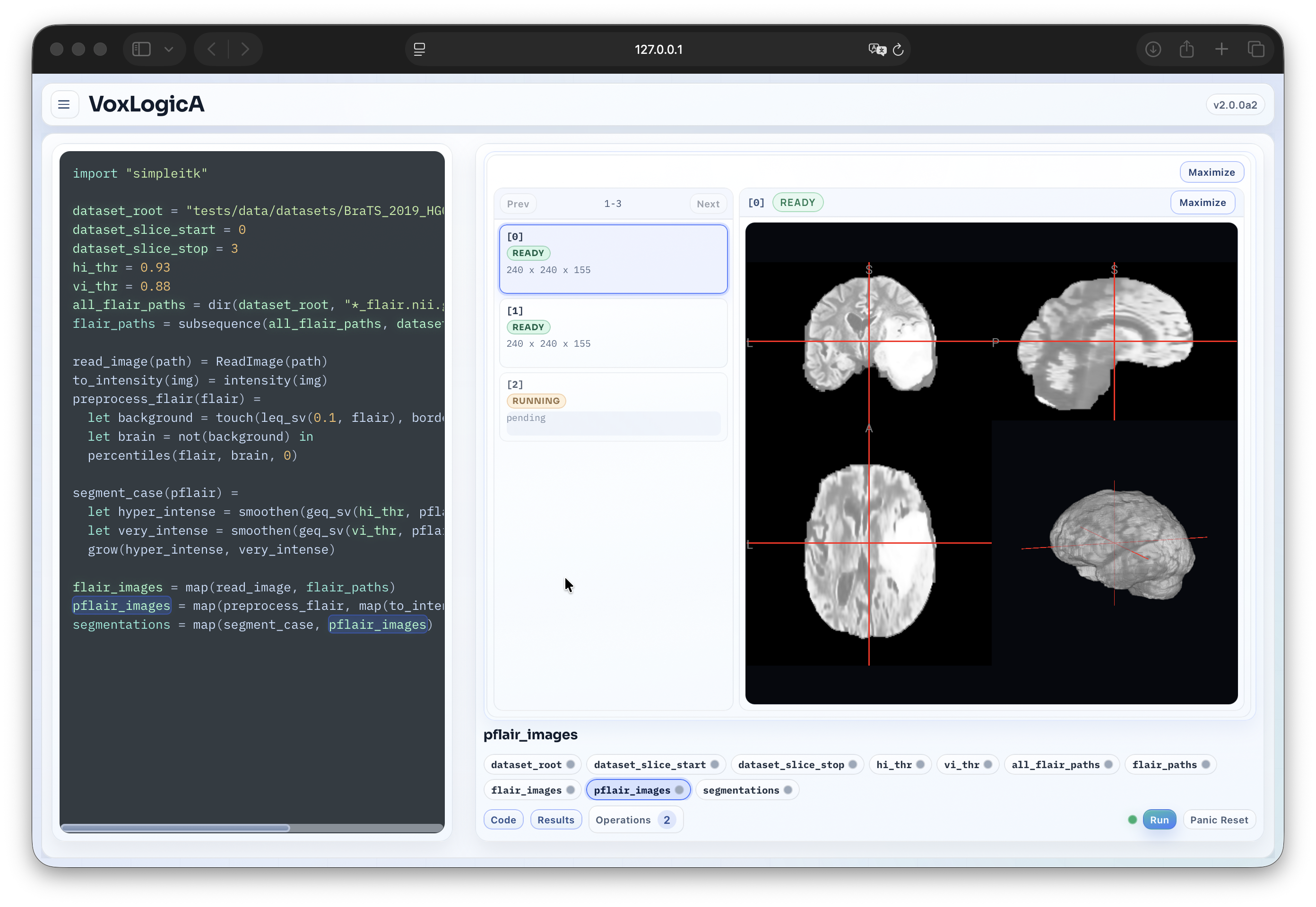 VoxLogicA 2 — hybrid AI workflow interface
